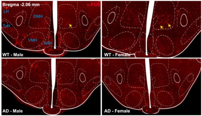 Immunofluorescence of  young male and female wild type (WT) and Alzheimer's Disease (AD) mouse brain labelling nucleus-specific c-Fos + cells in the DMH, VMH, ARH, TuN, and LH regions.   Image from publication CC-BY-4.0. PMID: 39272160