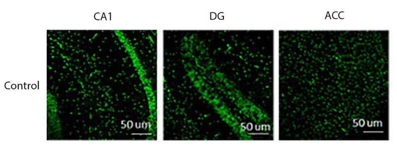 Immunolabeling on astroglial in the CA1 and DG mouse hippocampus, and anterior cingulate cortex (ACC) specifically labeling Connexin43 (Cat no 327-CON, green, 1:200). Image from publication. CC-BY-4.0 PMID: 37239279