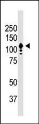 Western Blot of Y79 cells showing specific immunolabeling of human CD133. Band is at ~120 kDa due to protein glycosylation.