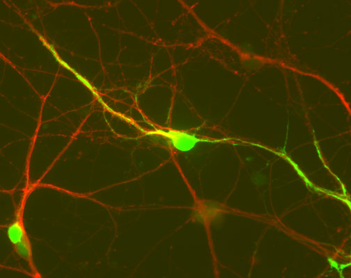 Immunochemical staining of cultured CD1 mouse striatal cells showing specific labeling of DARPP-32(cat. 374-DARPP, green, 1:250) and Tuj1(red). Cells and photo courtesy of QBM CellScience.