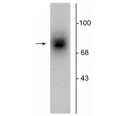 Western blot of human striatal lysate showing specific immunolabeling of the ~88 kDa DAT protein.