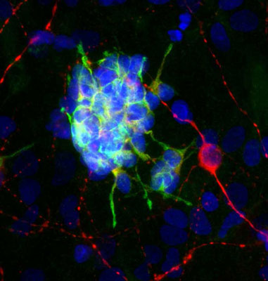 Immunofluorescence of cultured rat neurons showing strong cytoplasmic staining of doublecortin (cat. 451-DCX, 1:1000,green) in developing neurons and GFAP (cat. 621-GFAP, 1:1000, red)