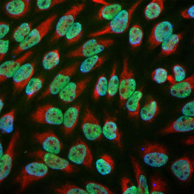 Immunofluorescence of HeLa cells showing clear localized labeling of the DNA in the nucleus with Anti-EWS (cat. 540-EWS, 1:1000, green) while Anti-Vimentin (cat. 2105-VIM, 1:5000, red) labels the cytoplasmic intermediate filament, and Hoechst DNA stain (blue).