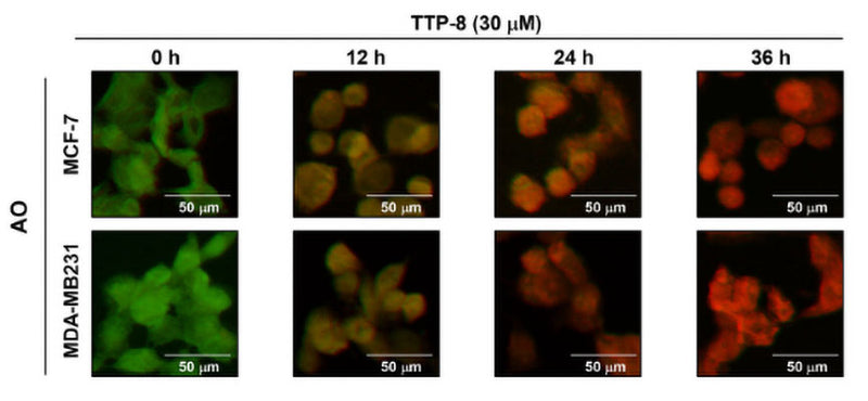 MCF-7 and MDA-MB231 cells (2  10 4 cells/well) seeded on 8 well chambers and treated TTP-8 (30 μM) for 0, 12, 24, and 36 hours. Acrinidine Orange (AO, Cat no 6130) staining assay was performed with confocal microcopy, and acid vesicular organelle (AVO) was dyed red. Image from publication, CC-BY-4.0, PMID: 39257214.