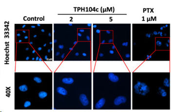 Representative images of BT-20 cells with vehicle (0 μM), 2, or 5 μM of TPH104c for 24 h or paclitaxel (PTX, 1 μM, a positive control) and stained with Hoechst 33342 dye (Cat no 639). TPH104c did not produce condensed or fragmented nuclei compared to cells incubated with paclitaxel (PTX). Scale bar = 25 μM. Image from publication, CC-BY-4.0, PMID: 39123351.   