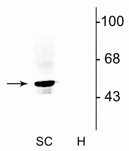 Western blot of rat spinal cord lysate (SC) showing specific immunolabeling of the ~48 kDa α1- and α2-subunits of the glycine receptor. Immunolabeling was absent from a rat hippocampal lysate (H), as the glycine receptor is not expressed in the hippocampus. 