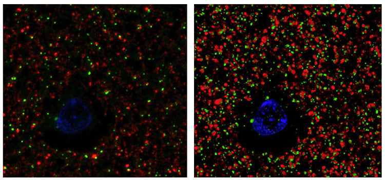 Immunofluorescence of human frontal cortex with K28/74 (green), rabbit Synapsin-1 (red) and DAPI (blue). Twelve images from 100 nm sections (left) were volume-reconstructed via array tomography (31.5 x 34 x 1.2 mm, right). Image courtesy of Nancy O’Rourke, Nafisa Ghori and Stephen Smith (Stanford).