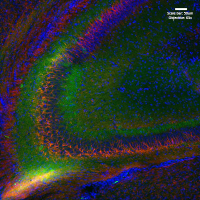 Immunolabeling of postnatal 14 mouse hippocampus specifically labeling Kv1.1 (Cat no 75-007, 1:200, green) and Ankyrin G (red). DNA labeled with DAPI. Mice were transcardially perfused with ice-cold 4% paraformaldehyde in PBS, then brain removed and postfixed overnight. The 50 uM slices were floating sections, where antigen retrieval was performed with sodium citrate at 80 C for 30 minutes before immunolabeling. Images from J. Ramirez-Franco and O. El Far, Aix-Marseille Université and INSERM.