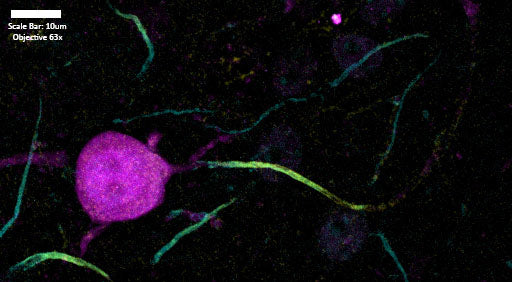 Immunolabeling of postnatal 14 mouse CA3 (Axonal Initial Segment, Parvalbumin positive interneuron) labeling Kv1.2 (75-008, 1:200, yellow) Parvalbumin (magenta), and Ankyrin G (cyan). Mice were transcardially perfused with cold 4% PFA in PBS, then brain removed and postfixed overnight. 50 uM slices as floating sections, antigen retrieval performed with sodium citrate at 80 C for 30 min. before immunolabeling. Images from J. Ramirez-Franco and O. El Far, Aix-Marseille Université and INSERM.