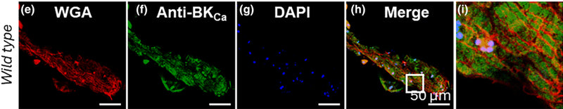 Drosophila cardiac tubes labeled with anti‐BKCa (cat. 75-022, 1:100) and wheat germ agglutinin (WGA, plasma membrane marker) isolated from wild‐type flies. (e) Cardiac tube labeled with WGA. (f) Cardiac tube labeled with anti‐BKCa. (g) Cardiac tube stained for nucleus with DAPI. (h) Merged image of (e, f) and (g, i) Enlarged region from a white box in (h) BKCa does not localize to the WGA labeled plasma membrane. Image from publication CC-BY-4.0. PMID:38561252