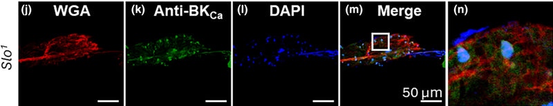 Drosophila cardiac tubes labeled with anti‐BKCa (cat. 75-022, 1:100) and WGA isolated from slo mutant flies. (j) Cardiac tube labeled with WGA. (k) Cardiac tube labeled with anti‐BKCa showed no significant labeling for BKCa. (l) Cardiac tube stained for nucleus with DAPI. (m) Merged image of (j, k) and (l, n) Enlarged region from a white box in m. Image from publication CC-BY-4.0. PMID:38561252