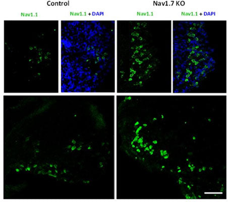 Immunolabeling of Nav1.1 (Cat No 75-023, 1:250) showing an increased expression in the Dorsal Root Ganglia of NaV1.7 knockout mice when compared to control mice. Image from publication. PMID: 39559752.
