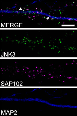 Coimmunofluorescence of endogenous JNK3 (green, Alexa488) with SAP102 (cat. 75-058; magenta, Alexa568) in MAP2-positive dendrites (blue, Alexa405) of primary rat hippocampal neurons (DIV22), analyzed by confocal microscopy. Image from publication CC-BY-4.0. PMID:38582451