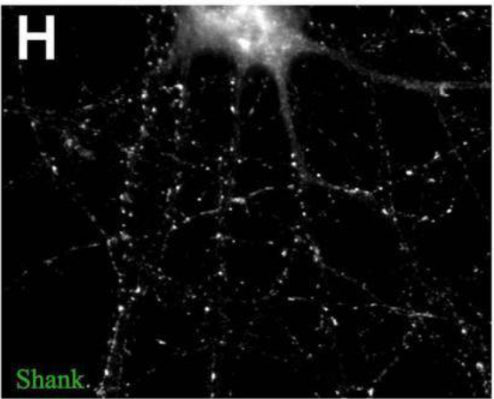 Immature synaptic structures in 11 DIV hippocampal neurons. Immunofluorescence images of 11 DIV HC following treatment with 100 μM glutamate for 15 min showing specific labelling of Shank (cat. 75-089, 1:100). Image from publication CC-BY-4.0. PMID:38660466