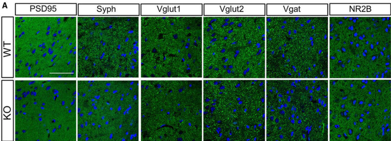 Representative images showing immunostaining of PSD95, synaptophysin (Syph), Vglut1, Vglut2, Vgat, and NR2b (cat. 75-101, 1:100) in the lateral nuclei of the amygdala (LA) of WT and Slitrk4 KO mice. Image from publication CC-BY-4.0. PMID:38736483