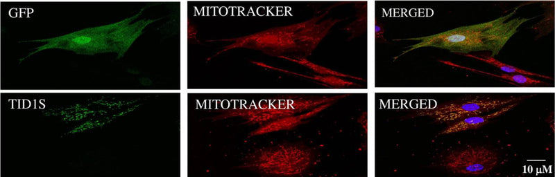 Human skin fibroblasts from healthy individuals were transduced with lentivirus carrying pHAGE-TID1S gene or vector control for 5 days prior to staining vector control with an anti-GFP antibody (cat. 75-131, 1:200) and TID1S  with an anti-TID1L/S antibody. Image from publication CC-BY-4.0. PMID:38495102