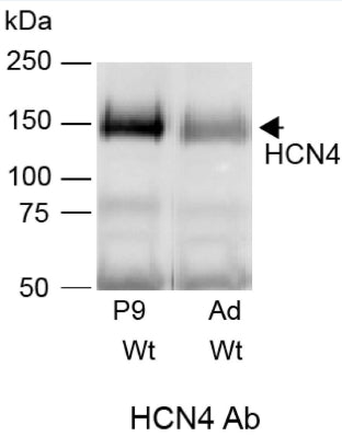 Immunoblots of membrane-enriched fraction from adult (Ad) and 9 (P9) or 11 (P11) postnatal days Wt and Sarm1−/− mice probed with anti-HCN4 (cat. 75-150, 1ug/ml). Image from publication CC-BY-4.0. PMID:38891076