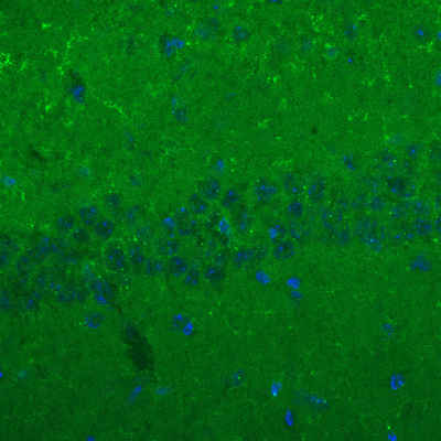 Immunolabeling of mouse hippocampus identifying GKAP (Anti-SAPAP, Cat no 75-156, green). Nuclear staining done with DAPI.  Image kindly provided by Huaye Zhang, Department of Neuroscience and Cell Biology, Rutgers Robert Wood Johnson Medical School. 