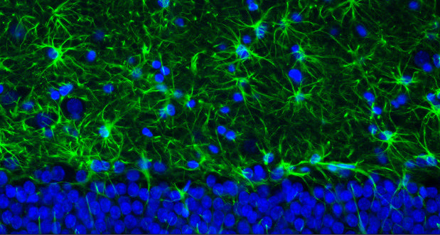 Representative section of formalin fixed, paraffin-embedded rat brain hippocampus region showing staining of GFAP. The sections were stained with Antibodies Incorporated anti-GFAP antibody (visualized in green) (Cat No. 75-240) at 1:500 dilution. The stained sections were mounted with Antibodies Incorporated FluoroshieldTM with DAPI and DABCO mounting medium (Cat. No. AR-6505). DAPI nuclear stain (blue) shows cell nuclei. Anti-GFAP specifically stains the astrocytes in the rat brain.