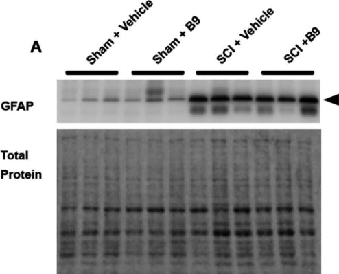 Western blot showing a band at the molecular weight corresponding to GFAP (cat. 75-240, 1:1000) in vehicle- or B9-treated sham and injured mice (top panel). The bottom panel shows the total protein loaded on each lane, which was used for normalization. Image from publication CC-BY-4.0. PMID:38302457