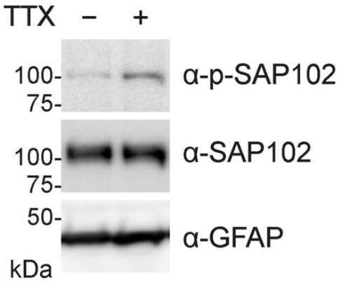 TTX treatment (2 μM, O/N) of primary rat hippocampal neuron cultures (DIV23) increases SAP102 phosphorylation, as observable by Western blot with the phospho-specific SAP102 antibody (α-p-SAP102). α-SAP102, and α-GFAP (cat. 75-240, 1:2000) served as controls. Image from publication CC-BY-4.0. PMID:38582451