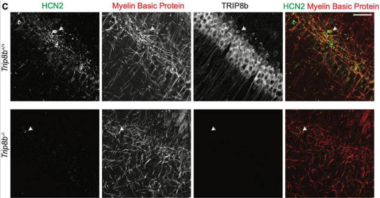 Immunohistochemistry of the cell body layer of CA1 of Trip8b+/+ and Trip8b–/– mice showing specific lableling of HCN2, Myelin Basic Protein, and TRIP8b (cat. 75-244, 1:1000). Image from publication CC-BY-4.0. PMID:38469353