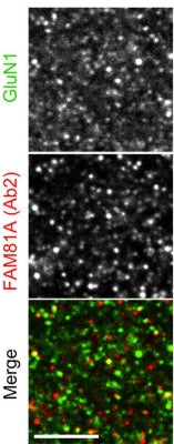 Immunohistochemistry of FAM81A and GluN1 (cat. 75-272) was performed on a section of adult mouse brain. Image from publication CC-BY-4.0. PMID:38452102