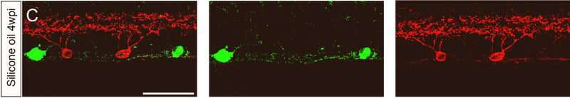Sample images for Spp1 (green) and Kv4.2 (cat. 75-361, 1:200; red) showing specific staining of this RGC subclass with silicone oil-induced Spp1 expression. Image from publication CC-BY-4.0. PMID:37624696