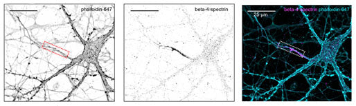 Confocal images of primary hippocampal neurons stained with phalloidin-647 (F-actin marker) and with an antibody against beta4-spectrin (Antibodies Inc; Cat