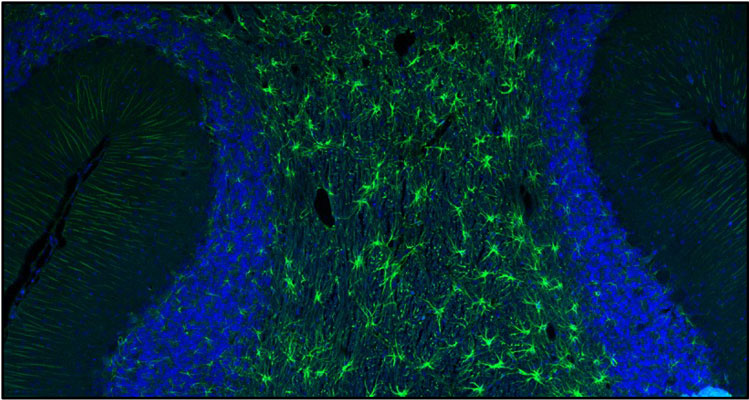 Representative section of formalin fixed, paraffin-embedded rat brain cerebellum region showing staining of GFAP with Aves Labs anti-GFAP recombinant chicken monoclonal antibody (visualized in green) (Cat No. 78-240) at 1:500 dilution. The stained sections were mounted with Antibodies Incorporated FluoroshieldTM with DAPI and DABCO mounting medium (Cat No. AR-6505). DAPI nuclear stain (blue) shows cell nuclei. Anti-GFAP specifically stains the astrocytes in the rat brain. Magnification 100X. 