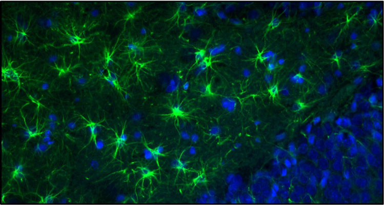 Representative section of formalin fixed, paraffin-embedded rat brain showing staining of GFAP. The sections were stained with Aves Labs anti-GFAP recombinant chicken monoclonal antibody (visualized in green, Cat No. 78-240) at 1:500 dilution. The stained sections were mounted with Antibodies Incorporated FluoroshieldTM with DAPI and DABCO mounting medium (Cat No. AR-6505). DAPI nuclear stain (blue) shows cell nuclei. Anti-GFAP specifically stains the astrocytes in the rat brain. Magnification 400X.