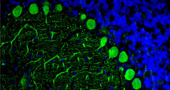 Representative section of formalin fixed, paraffin-embedded rat brain cerebellum region showing staining of Purkinje cells by Aves Labs anti-CALB1 recombinant chicken monoclonal antibody (visualized in green, Cat No. 78-448) at 1:100 dilution. The stained sections were mounted with Antibodies Incorporated FluoroshieldTM with DAPI and DABCO mounting medium (Cat No AR-6505). DAPI nuclear stain (blue) shows cell nuclei. Anti-CALB1 specifically stains the Purkinje cells in the cerebellum. Magnification 400X.