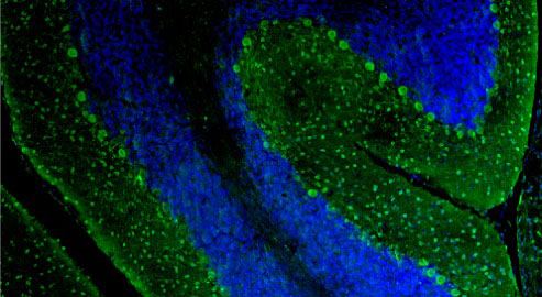 Representative section of formalin fixed, paraffin-embedded rat brain cerebellum region showing staining of Purkinje cells and neurons of the molecular layer with Aves Labs anti-Parvalbumin recombinant chicken monoclonal antibody (visualized in green, Cat No. 78-479) at 1:100 dilution. The stained sections were mounted with Antibodies Incorporated FluoroshieldTM with DAPI and DABCO mounting medium (Cat No. AR-6505). DAPI nuclear stain (blue) shows cell nuclei. Magnification 100X.