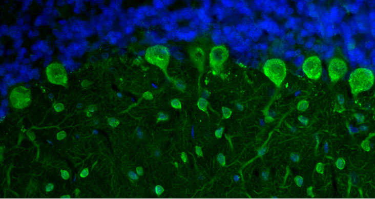 Representative section of formalin fixed, paraffin-embedded rat brain cerebellum region showing staining of Purkinje cells and neurons of the molecular layer with Aves Labs anti-Parvalbumin recombinant chicken monoclonal antibody (visualized in green, Cat No. 78-479) at 1:100 dilution. The stained sections were mounted with Antibodies Incorporated FluoroshieldTM with DAPI and DABCO mounting medium (Cat No. AR-6505). DAPI nuclear stain (blue) shows cell nuclei. Magnification 400X.