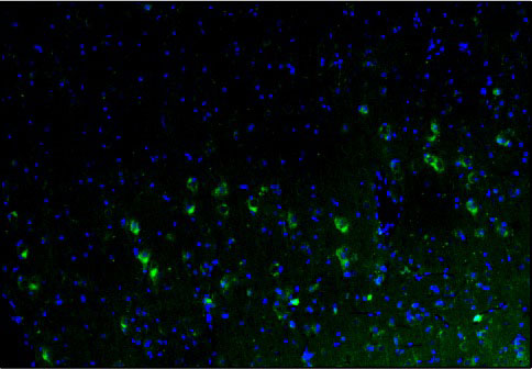 Representative section of formalin fixed, paraffin-embedded rat brain cerebral cortex showing cells stained by anti-Calretinin antibody. The sections were stained with Aves Labs anti-Calretinin recombinant chicken monoclonal antibody (visualized in green, Cat No. 78-488) at 1:100 dilution. The stained sections were mounted with Antibodies Incorporated FluoroshieldTM with DAPI and DABCO mounting medium (Cat No. AR-6505). DAPI nuclear stain (blue) shows cell nuclei. Magnification 100X.