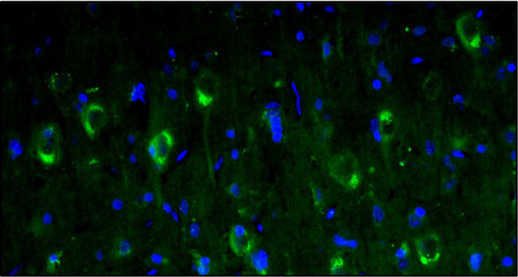 Representative section of formalin fixed, paraffin-embedded rat brain cerebral cortex showing staining cells by anti-Calretinin antibody. The sections were stained with Aves Labs anti-Calretinin recombinant chicken monoclonal antibody (visualized in green, Cat No. 78-488) at 1:100 dilution. The stained sections were mounted with Antibodies Incorporated FluoroshieldTM with DAPI and DABCO mounting medium (Cat No. AR-6505). DAPI nuclear stain (blue) shows cell nuclei. Magnification 400X.