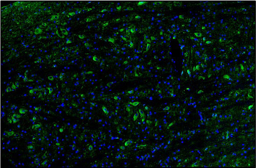 Representative section of formalin fixed, paraffin-embedded rat brain stem showing microglia cells stained by anti-TMEM119 antibody. The sections were stained with Aves Labs anti-TMEM119 recombinant chicken monoclonal antibody (visualized in green, Cat No. 78-512) at 1:100 dilution. The stained sections were mounted with Antibodies Incorporated FluoroshieldTM with DAPI and DABCO mounting medium (Cat No. AR-6505). DAPI nuclear stain (blue) shows cell nuclei. Magnification 100X.