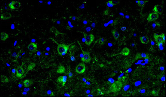 Representative section of formalin fixed, paraffin-embedded rat brain stem showing microglia cells stained by anti-TMEM119 antibody. The sections were stained with Aves Labs anti-TMEM119 recombinant chicken monoclonal antibody (visualized in green, Cat No. 78-512) at 1:100 dilution. The stained sections were mounted with Antibodies Incorporated FluoroshieldTM with DAPI and DABCO mounting medium (Cat No. AR-6505). DAPI nuclear stain (blue) shows cell nuclei. Magnification 400X.