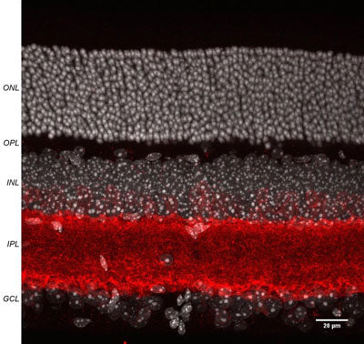 Immunoflouresence of mouse retina specifically labeling GAT-1 protein (cat. 880-GAT1, red, 1:500) in the inner plexiform layer (IPL). The white identifies nuclei stained with DAPI. The retina was fixed with 4% paraformaldehyde for 30 minutes, embedded in 5% agarose, and sliced into 60 micron thick slices with a vibratome. The image is a Z-stack taken from a confocal microscope. Image courtesy of Andrea Wellington, Assistant Research Scientist, University of Arizona Physiology Dept.