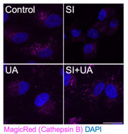 SI induces severe lysosomal membrane permeabilization (LMP) and activation of the CLEAR network. Representative images of the number of cells with Cathepsin B activity (Cat no 937, MagicRed, magenta), nuclei were counterstained with DAPI (blue). Scale bars, 25 μm. Image from publication CC-BY-4.0. PMID: 38890703 