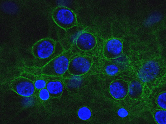 Immunofluorescence of cultured neurons and glia cells showing specific axonal and dendritic labeling with anti-alpha-II-spectrin (cat. 98-A2SM, 1:500, green), and nuclear staining with DAPI (blue). 