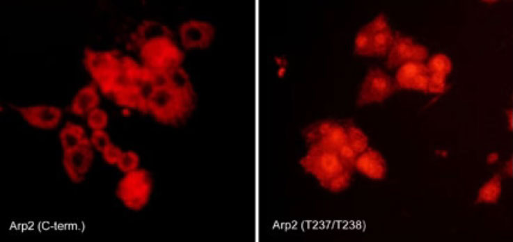 Immunocytochemical labeling of Arp2 phosphorylation in rat PC12 cells differentiated with NGF. The cells were probed with Arp2 (C-terminal region) and Arp2 (Thr-237/Thr-238) rabbit polyclonal antibodies, then the antibodies were detected using appropriate secondary antibody conjugated to Cy3.