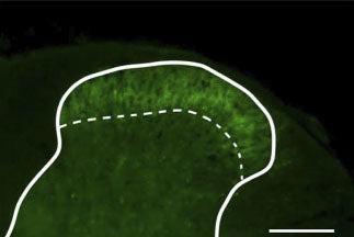 Distribution of α2δ-1 subunit in spinal dorsal horn. The spinal dorsal horn sections of CV mice were stained with anti-α2δ-1 antibody (green). Scale bar = 200 µm. Solid line represents the gray matter border, dotted line represents the superficial layer. Sections mounted with Fluoroshield medium (Cat no AR-6500, ImmunoBioScience Corp). Image from publication CC-BY-4.0. PMID: 38989140