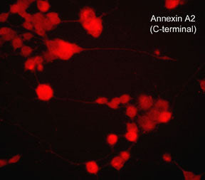 Immunocytochemical labeling of Annexin A2 in NGF-differentiated rat PC12 cells. The cells were fixed in paraformaldehyde and permeabilized using NP-40, then labeled with mouse monoclonal Annexin A2 (C-terminal region). The antibody was detected using goat anti-mouse DyLight® 594.