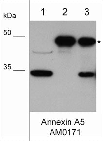 Western blot of A431 cell lysate only (lane 1), AM0171 antibody only (lane 2), and AM0171 antibody immunoprecipitate from A431(lane 3). The blot was probed with mouse monoclonal anti-Annexin A5 antibody (AM0171) at 1:500 (lanes 1-3). The asterisk shows the antibody heavy chain in immunopreciptates at 50 kDa, while Annexin A5 band is observed at 35 kDa.