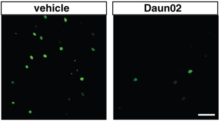 Transgenic rats that received vehicle (left panel) or Daun02 (right panel) were perfused 90 min after the last CS1 presentation and analyzed for the expression of β-galactosidase (β-gal) (cat. BGL, 1:1000). Image from publication CC-BY-4.0. PMID:38656872