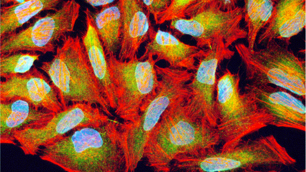 Immunofluorescent staining of HeLa cells using 2 µg/mL Aves Labs chicken anti-Calnexin (CANX) (Cat. No. CANX-0100) antibody (green). Actin filaments were stained using Phalloidin (red). DAPI nuclear stain (blue) shows cell nuclei. The cells were mounted with Antibodies Incorporated Fluoroshield with DAPI mounting medium (Cat. No. AR-6501). Anti-Calnexin specifically stains the Endoplasmic Reticulum in HeLa cells. ​