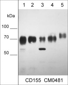 Western blot of human A549 lung carcinoma (lane 1), NCI-H446 small cell lung carcinoma (lane 2), NCI-H1299 lung carcinoma (lane 3), MDA-MB-231 breast carcinoma (lane 4), and A431 epidermoid carcinoma (lane 5). The blot was probed with mouse monoclonal anti-CD155 (CM0481) at 1:500.