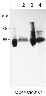 Immunocytochemical labeling of CD44 in paraformaldehyde fixed human A431 cells. The cells were labeled with mouse monoclonal anti-CD44 (clone M010). The antibody was detected using goat anti-mouse DyLight® 594.