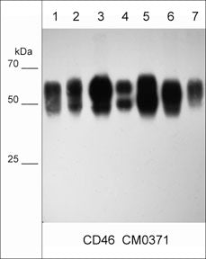 Western blot of native lysates from NCI-H2052 mesothelial cells (lane 1), SK-MES-1 squamous carcinoma (lane 2), MDA-MB-231 breast carcinoma (lane 3), MeWo melanoma (lane 4), A431 skin adenocarcinoma (lane 5), LNCaP prostate cancer cells (lane 6), and MCF7 breast cancer cells (lane 7). The blot was probed with mouse monoclonal anti-CD46 (CM0371) at 1:1000.